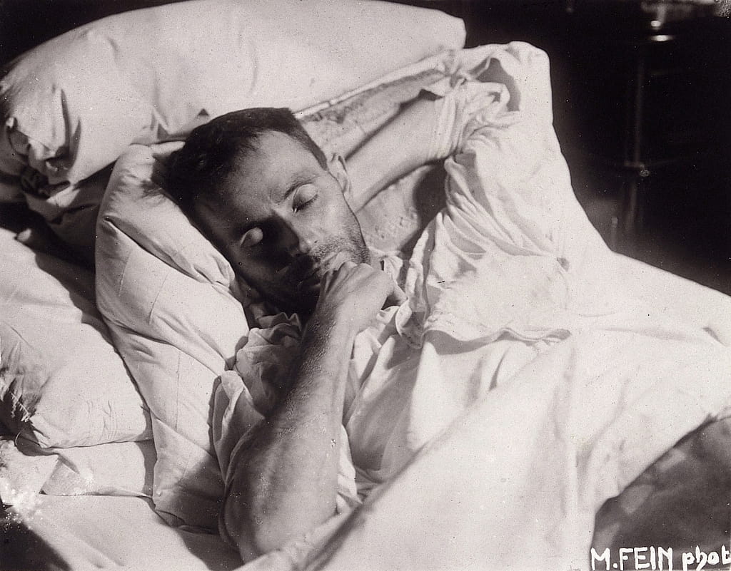 Egon Schiele auf seinem Sterbebett, 1918. fotografiert von Martha Fein
